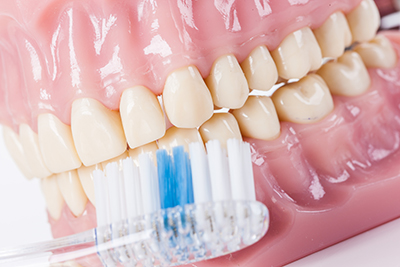 Zahnpflegetipps Prothesen